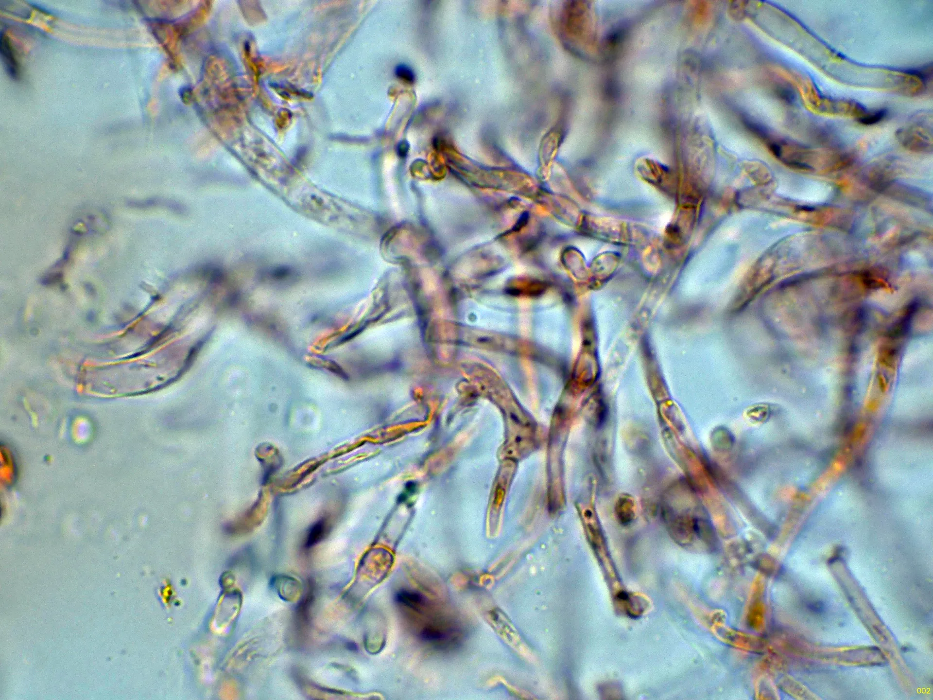Microscopía de Tremella aurantia - 4 - Hifas contexto-002